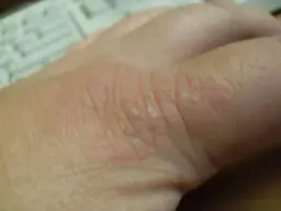 Mutilatorcarbswap061.webp