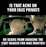 thumb_is-that-acne-on-your-face-private-or-scars-from-57315685.png